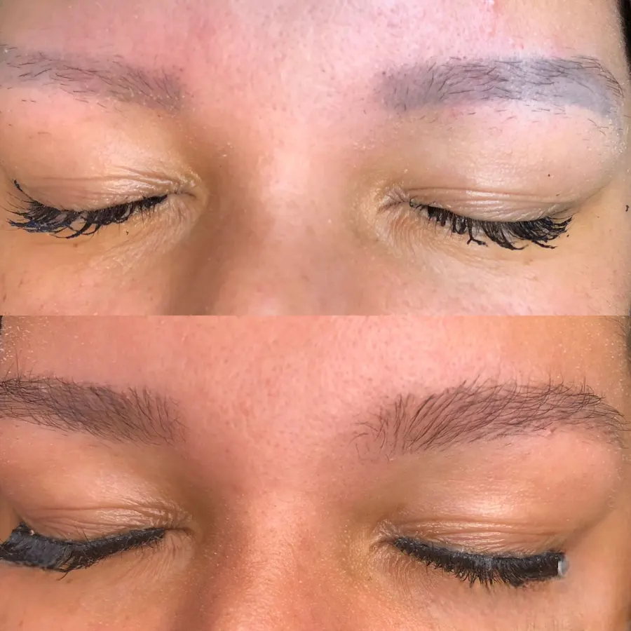 Antes e depois — micropigmentação